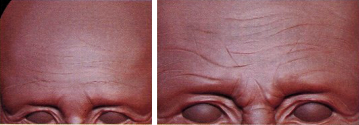 ZBrush皱纹雕刻