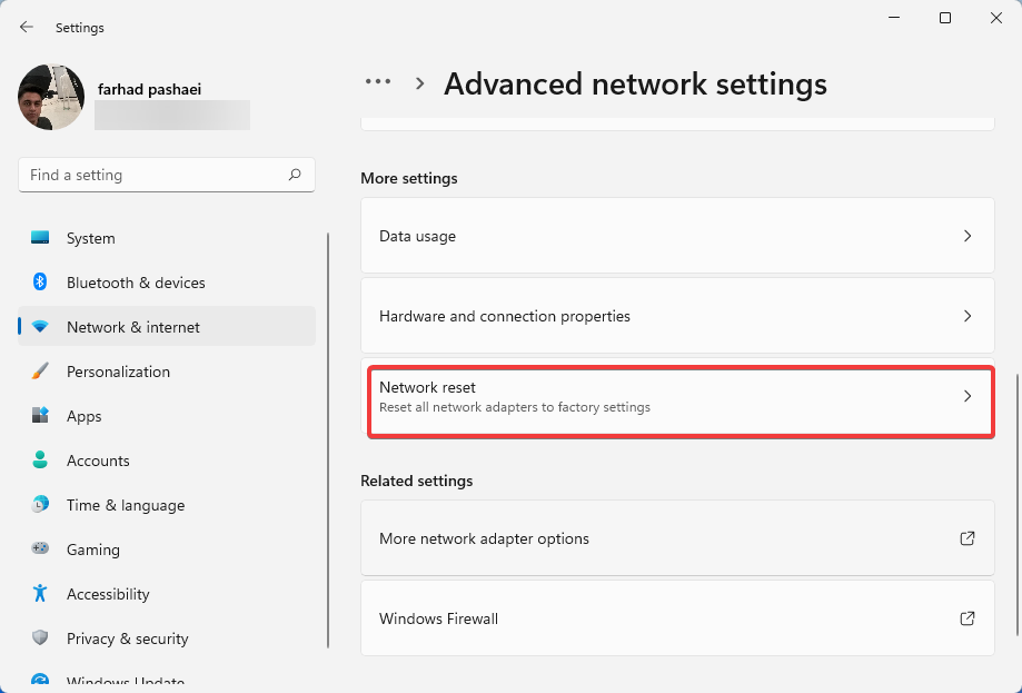 如何快速解决 Windows 11 的代理错误问题