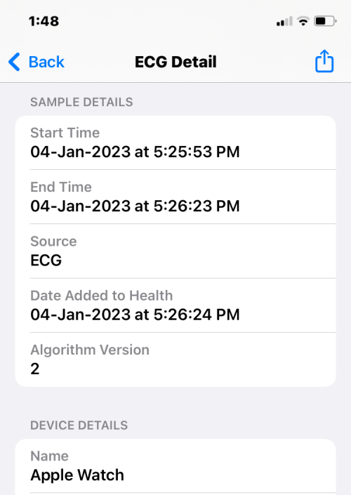 Apple Watch 心电图记录：详细步骤指南
