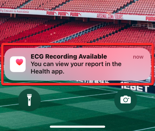 如何在 Apple Watch 上记录心电图：分步操作指南