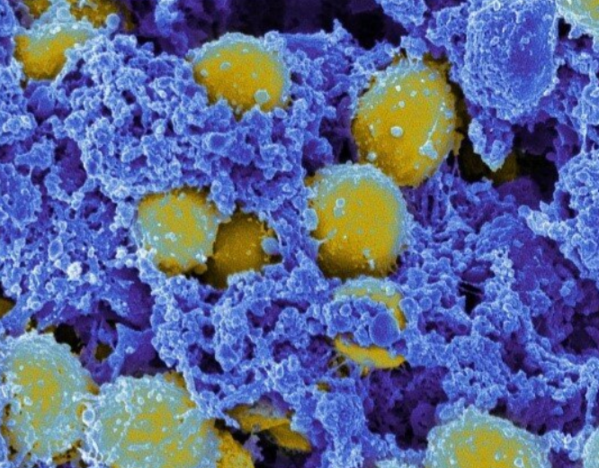 Nature|从1.07亿个分子中发现新抗菌化合物,MIT团队开发用于抗生素发现的DL方法