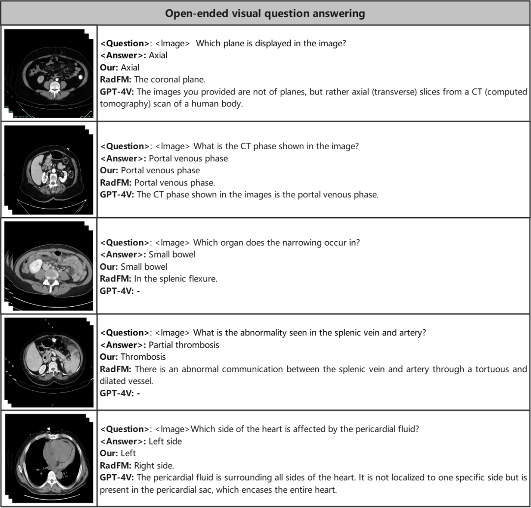 涵盖文本、定位和分割任务,智源、港中文联合提出首个多功能3D医学多模态大模型