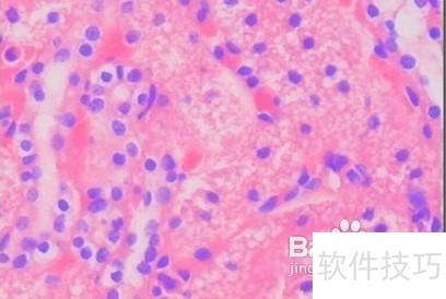 健康体检项目有哪些？全面解析体检内容