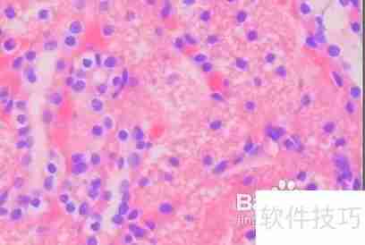 健康体检都包含哪些内容？全面了解体检项目