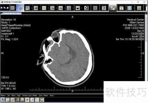 LEADTOOLS医学影像工作站使用教程