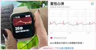 Apple Watch如何查看心电图