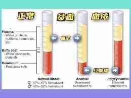贫血是因为身体血液量少吗