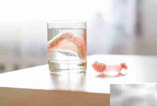 活动义齿优缺点及护理方法