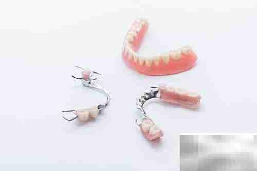 活动义齿优缺点及护理方法