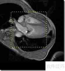 LEADTOOLS医学影像浏览器入门指南