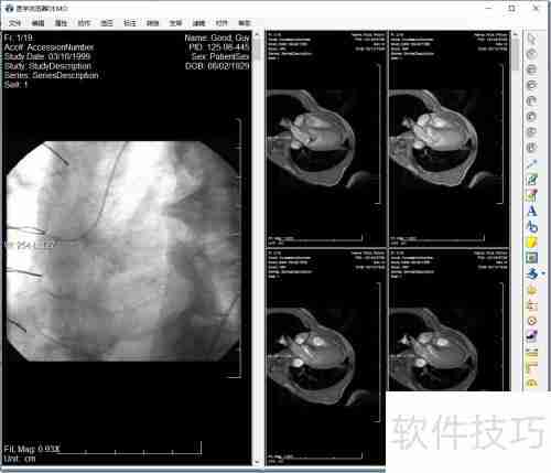 LEADTOOLS医学影像浏览器入门指南