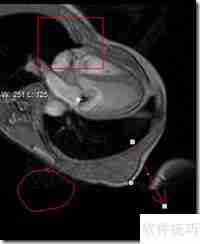 LEADTOOLS医学影像浏览器入门指南
