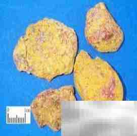 雄黄驱蜈蚣妙招