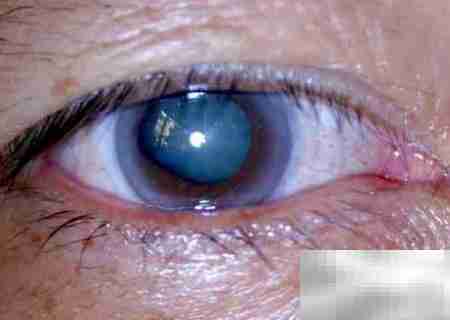 关灯玩手机有哪些危害？