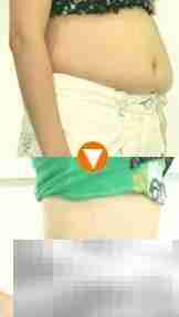 水动力抽脂价格一览