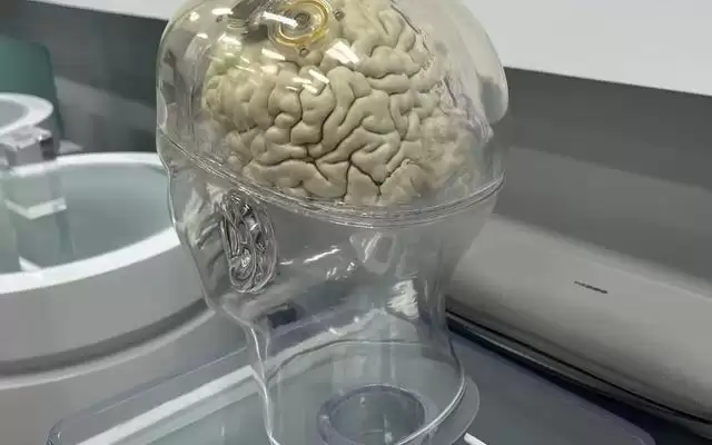 智冉医疗叩开脑机接口新大门：从1到N，冲刺直道超车