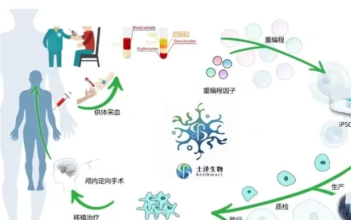国产帕金森病创新药研发迎来里程碑，在中美两国取得进展