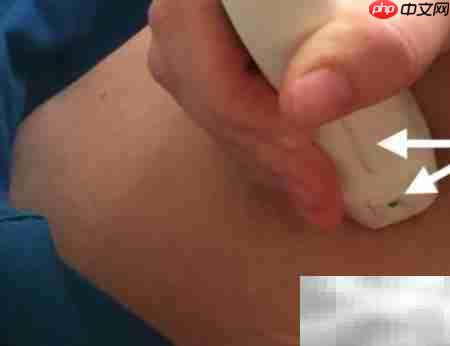 超声探头使用指南